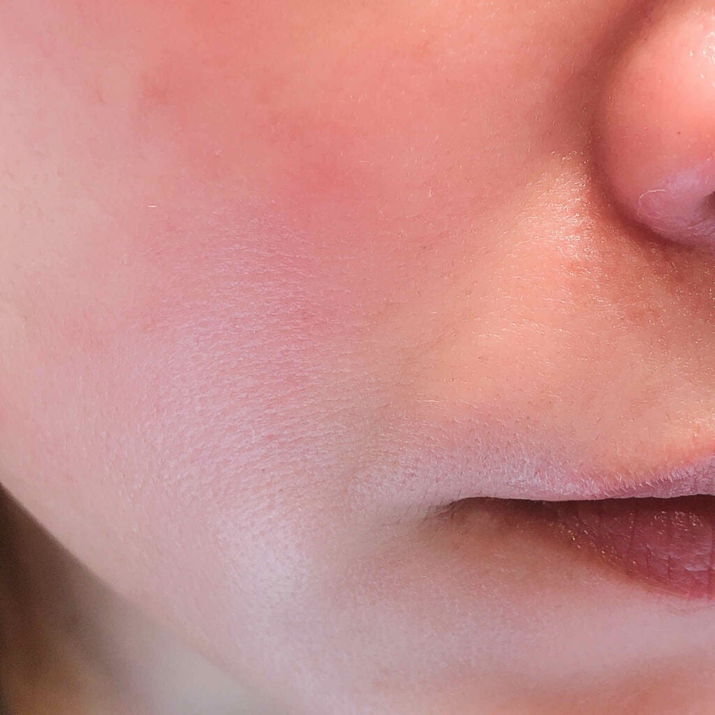 リアルヒアルロニック ブルーワンデーキット/Wellage/美容液を使ったクチコミ(3枚目)