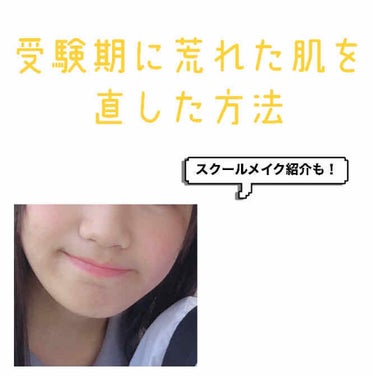 私が高校受験の受験勉強で荒れた肌を直した方法を紹介します！
↓
↓
私はストレスからなのか肌が荒れました。
ストレス溜めてる気はまったくなかったです。笑


２枚目の写真で分かる様に頬にはブツブツがいっ