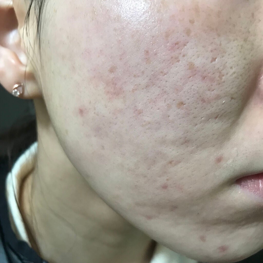 マデカソ 美容液/A’pieu/美容液を使ったクチコミ(1枚目)