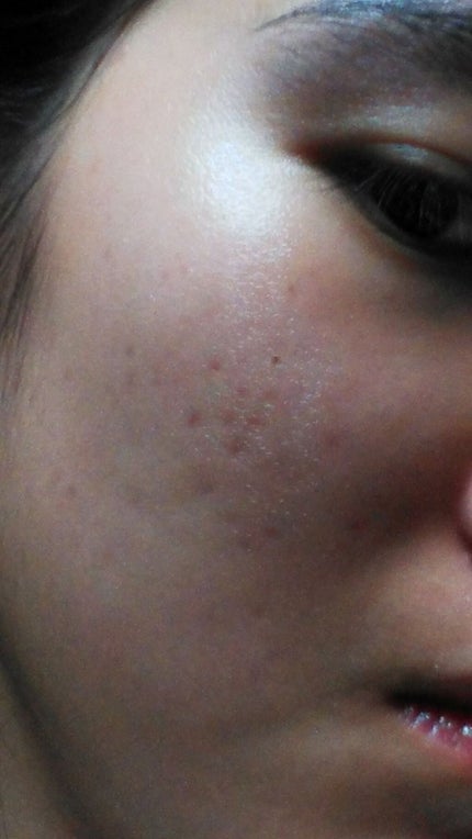 薬用 しみ 集中対策 美容液/メラノCC/美容液を使ったクチコミ(3枚目)