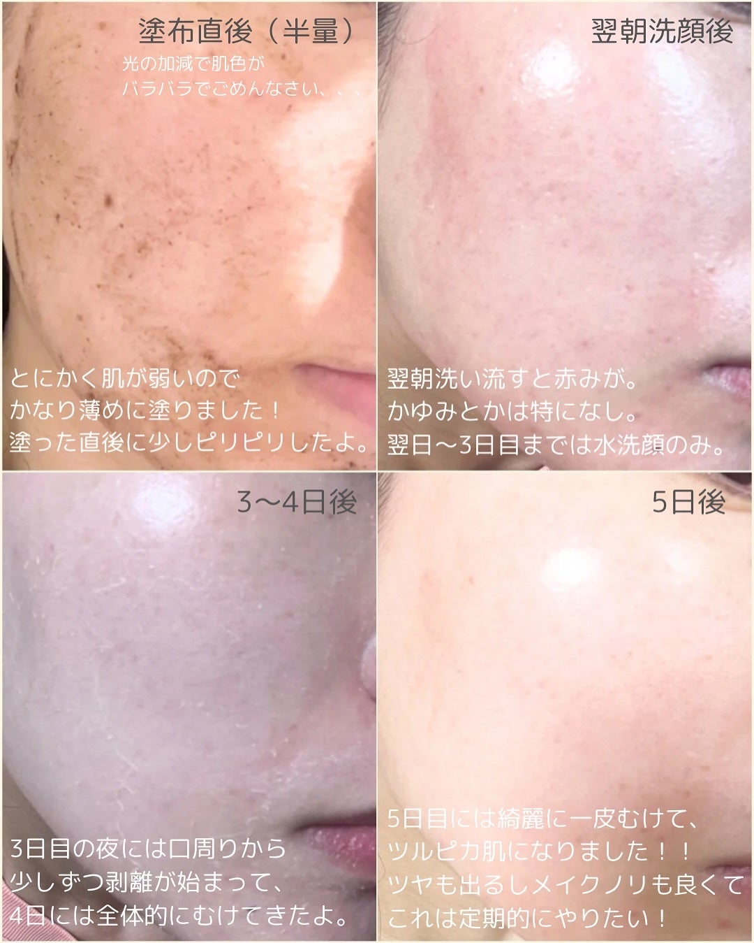 ダーマスキンピーリング/BQCELL/その他キットセットを使ったクチコミ(4枚目)