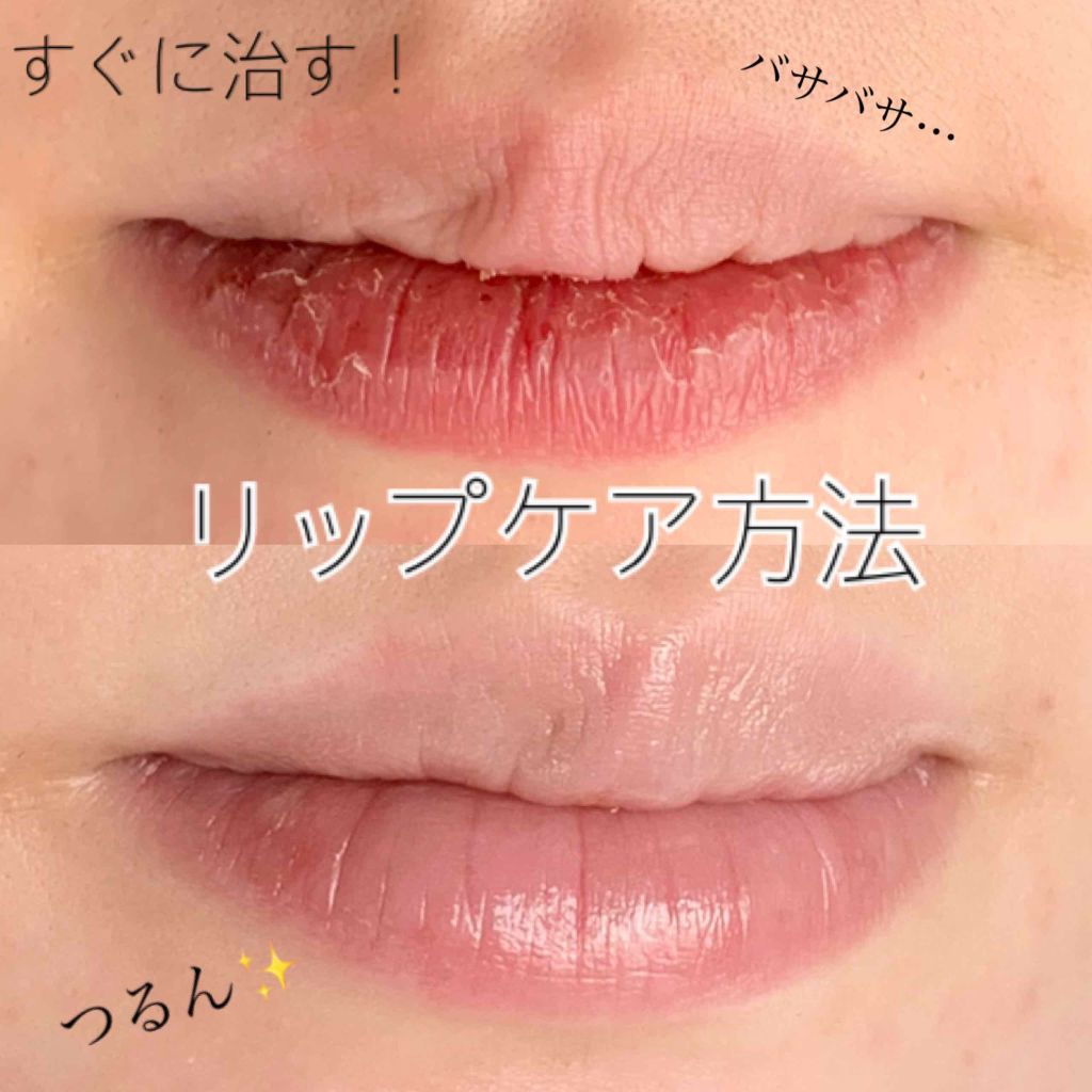 リップパック /CHOOSY/リップマスクを使ったクチコミ(1枚目)