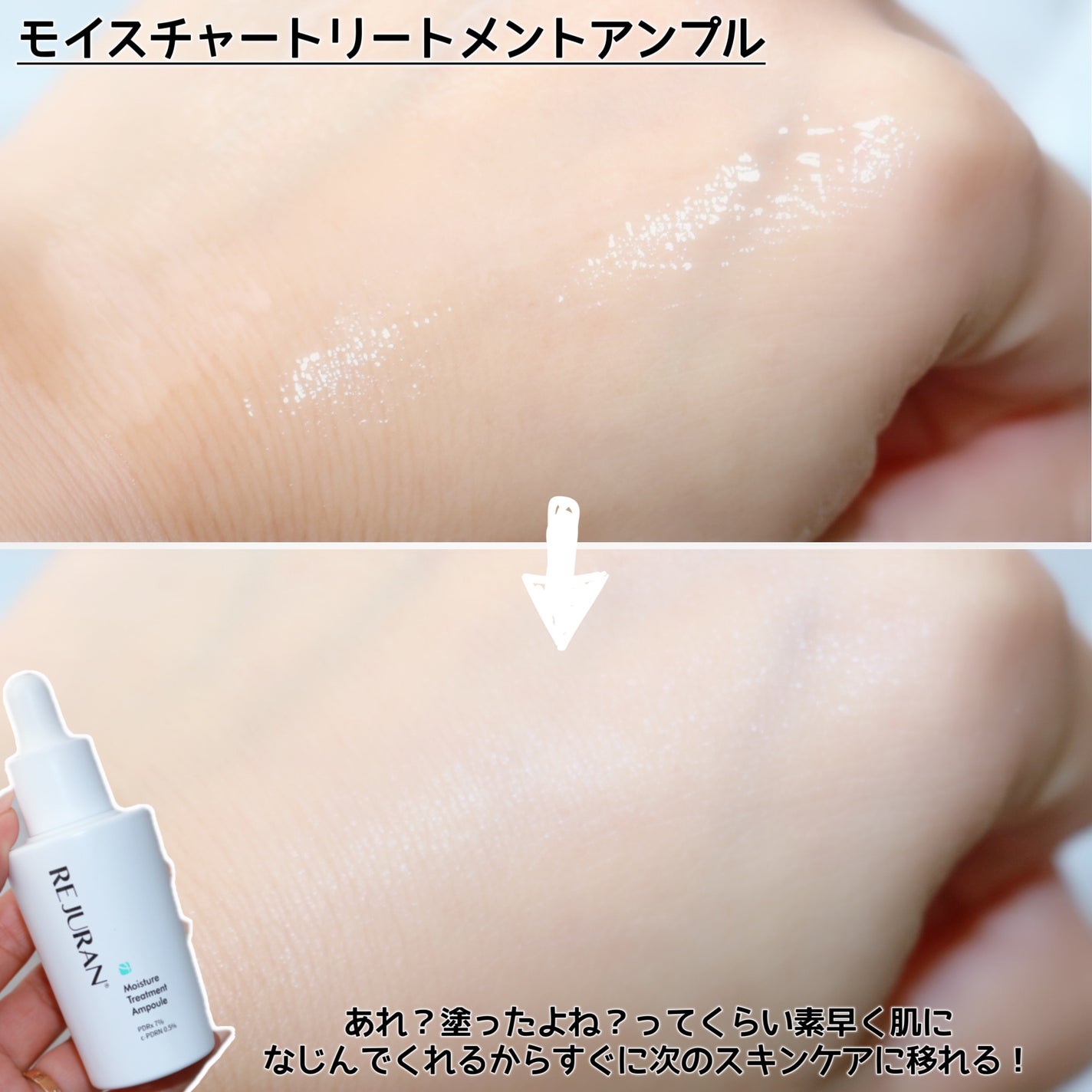 モイスチャートリートメントアンプル/REJURAN COSMETICS/美容液を使ったクチコミ(5枚目)