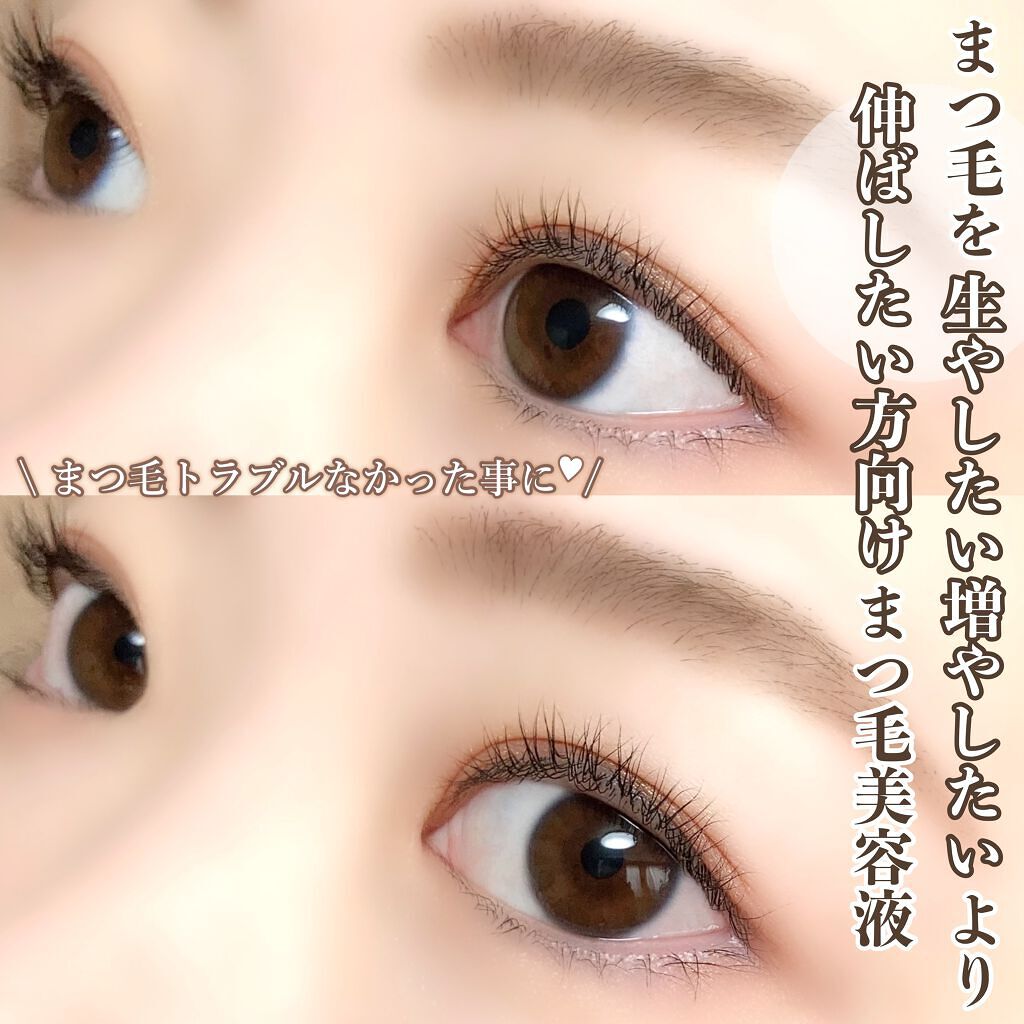 スカルプDボーテ ピュアフリーアイラッシュセラム プレミアムクイーン/アンファー(スカルプD)/まつげ美容液を使ったクチコミ(4枚目)