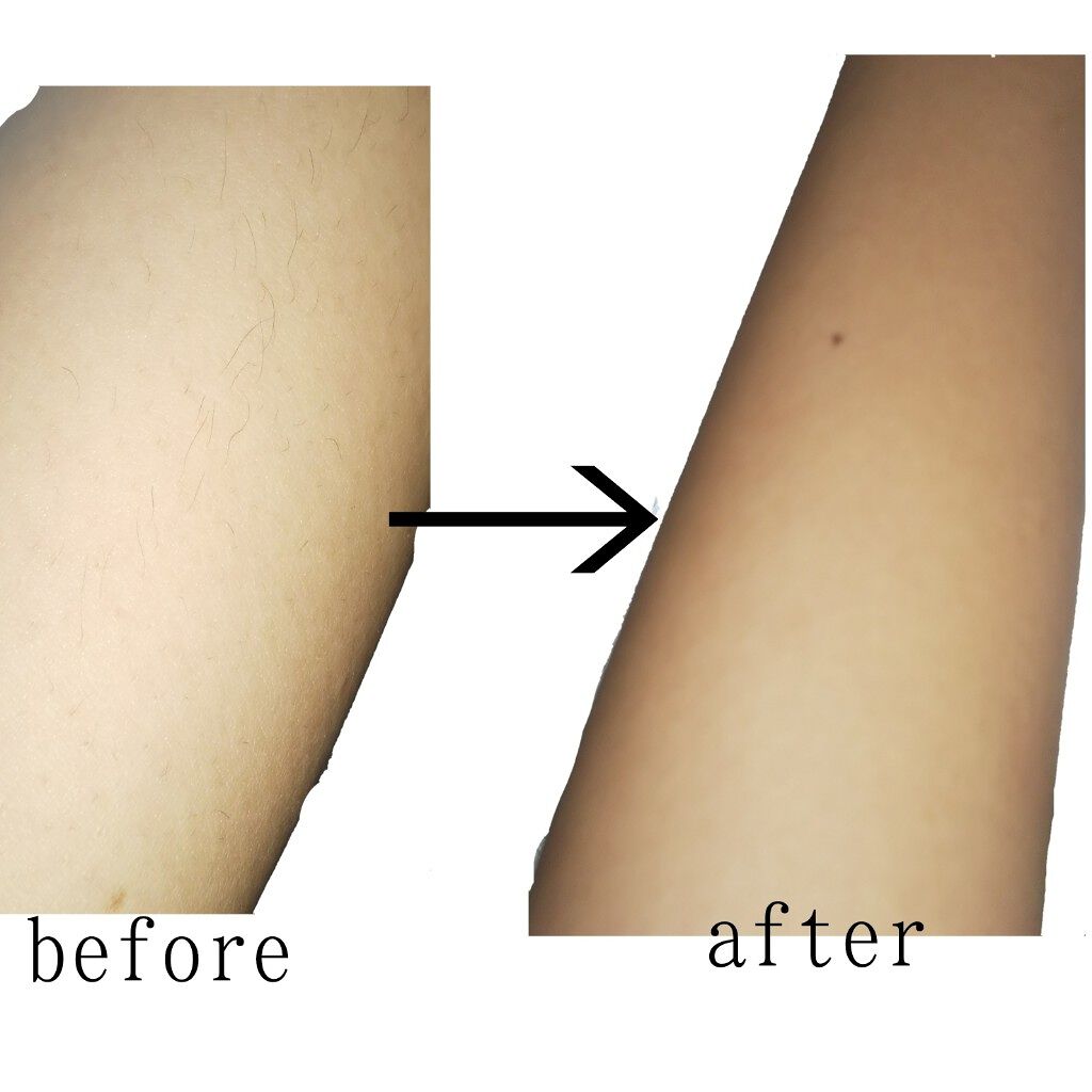 つるすべ除毛パッド/DAISO/ムダ毛ケアを使ったクチコミ(3枚目)