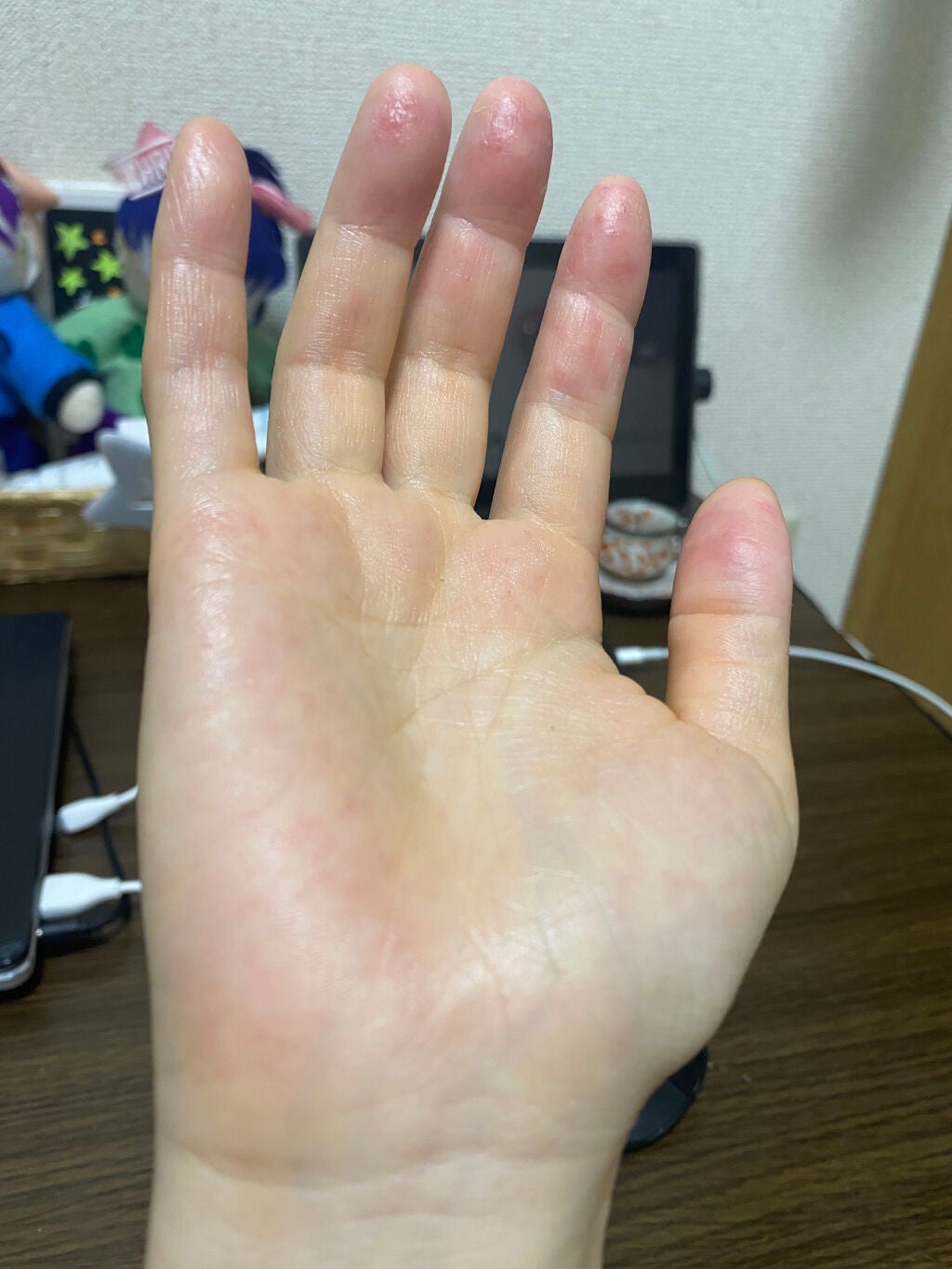 薬用ハンドクリーム/アベンヌ/ハンドクリームを使ったクチコミ(6枚目)