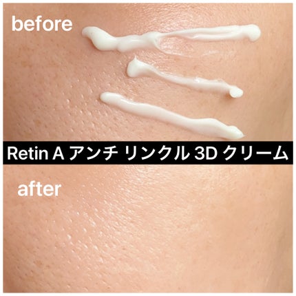 Retin A アンチ リンクル3Dクリーム/theralogic/フェイスクリームを使ったクチコミ(7枚目)