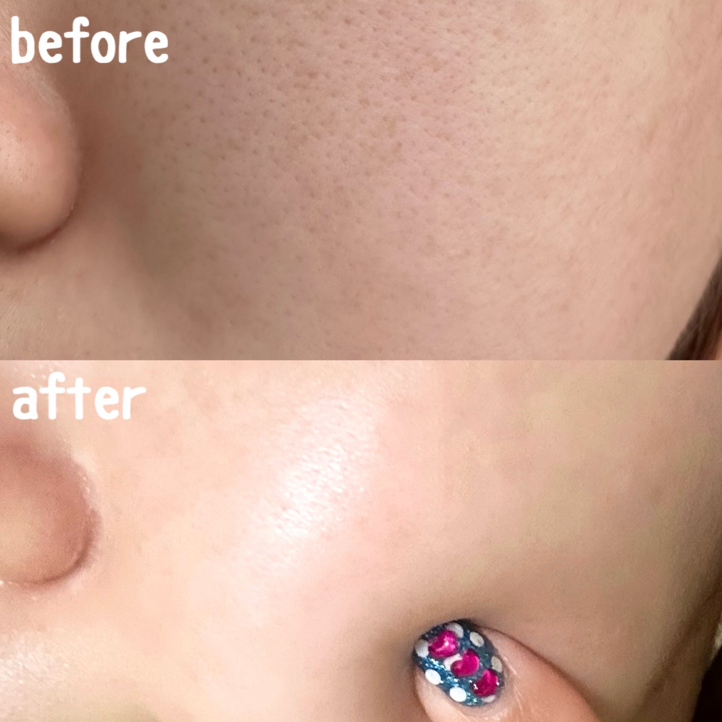 ドクタージー ピュア ビタミンA ファーミングマスク/Dr.G/シートマスク・パックを使ったクチコミ(4枚目)