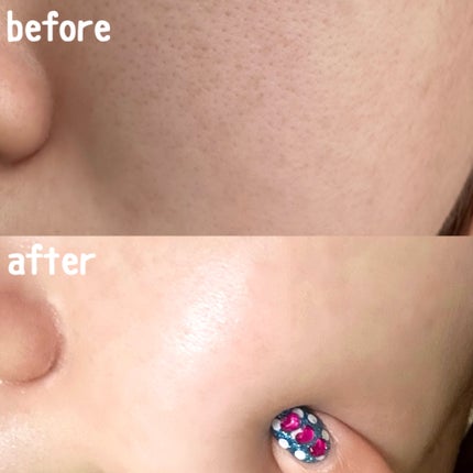 ドクタージー ピュア ビタミンA ファーミングマスク/Dr.G/シートマスク・パックを使ったクチコミ(4枚目)