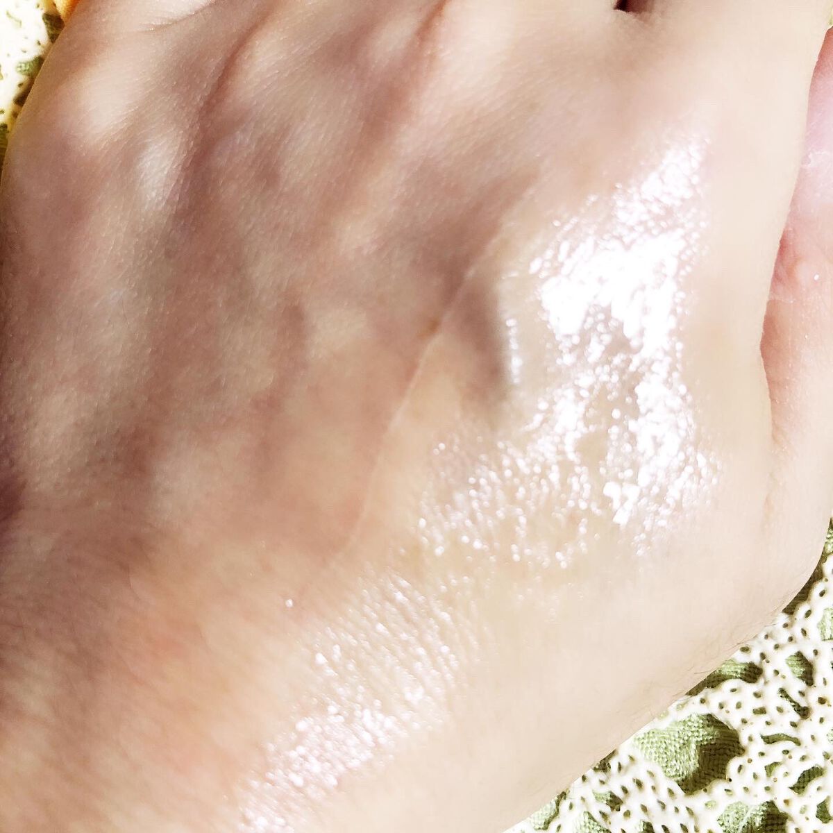 アクネケア 化粧液　＜医薬部外品＞/ファンケル/化粧水を使ったクチコミ（3枚目）