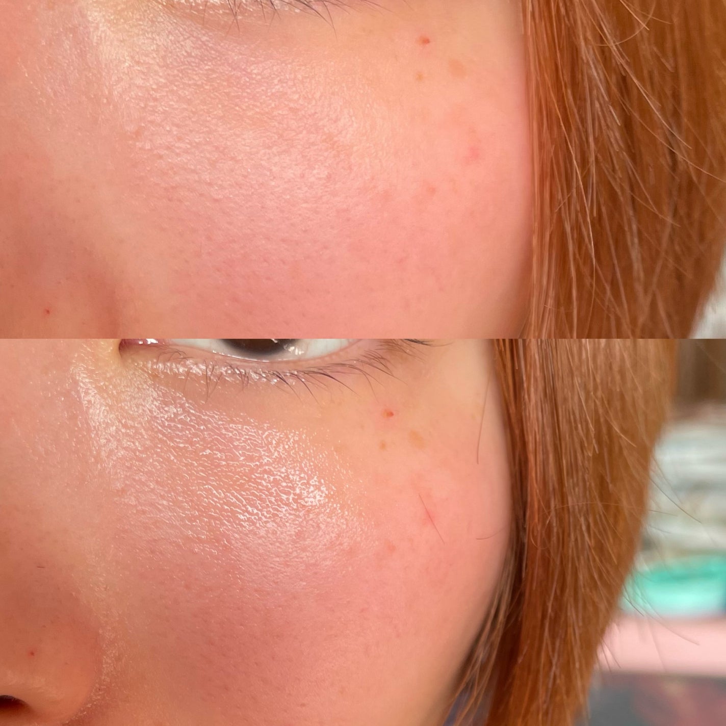 ピンクティーツリーシナジーセラム/APLIN/美容液を使ったクチコミ(2枚目)