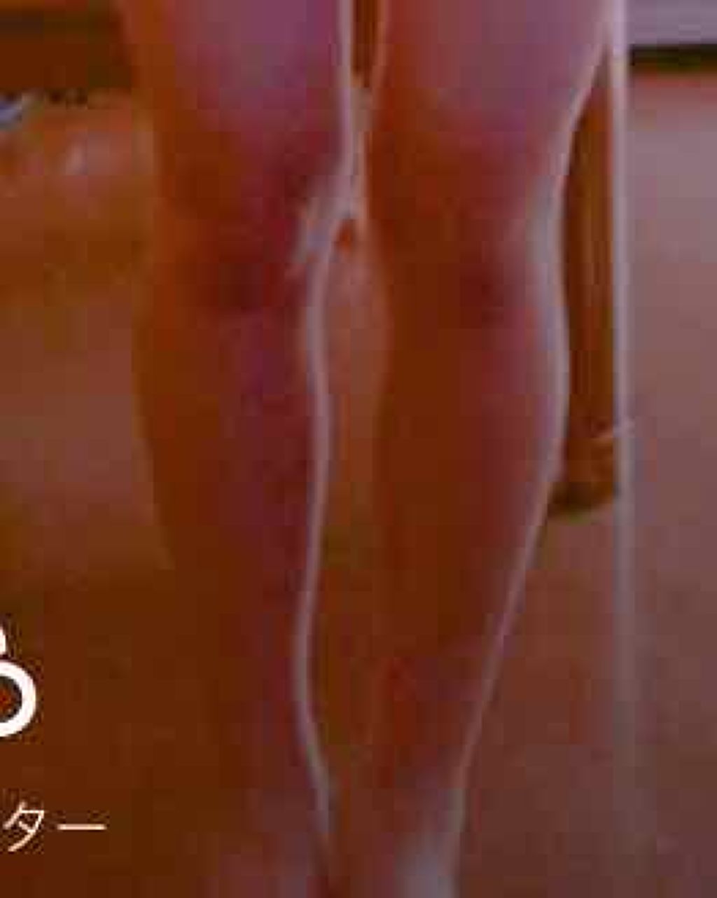 れもん on LIPS 「中3女子です。足が太いのがコンプレックスで筋肉足です💦あと膝が..」(1枚目)