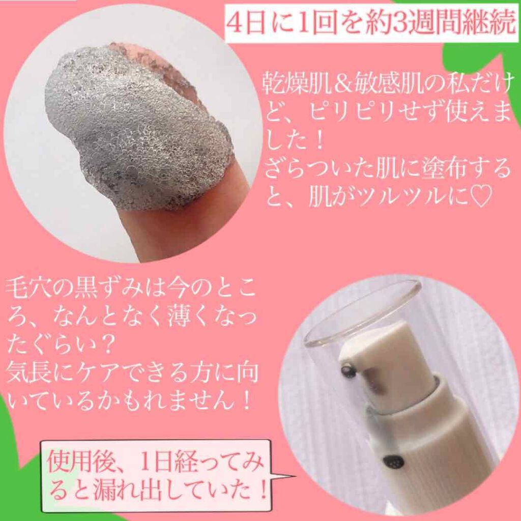 JUSO KURO PACK/NAKUNA-RE/洗い流すパック・マスクを使ったクチコミ（3枚目）