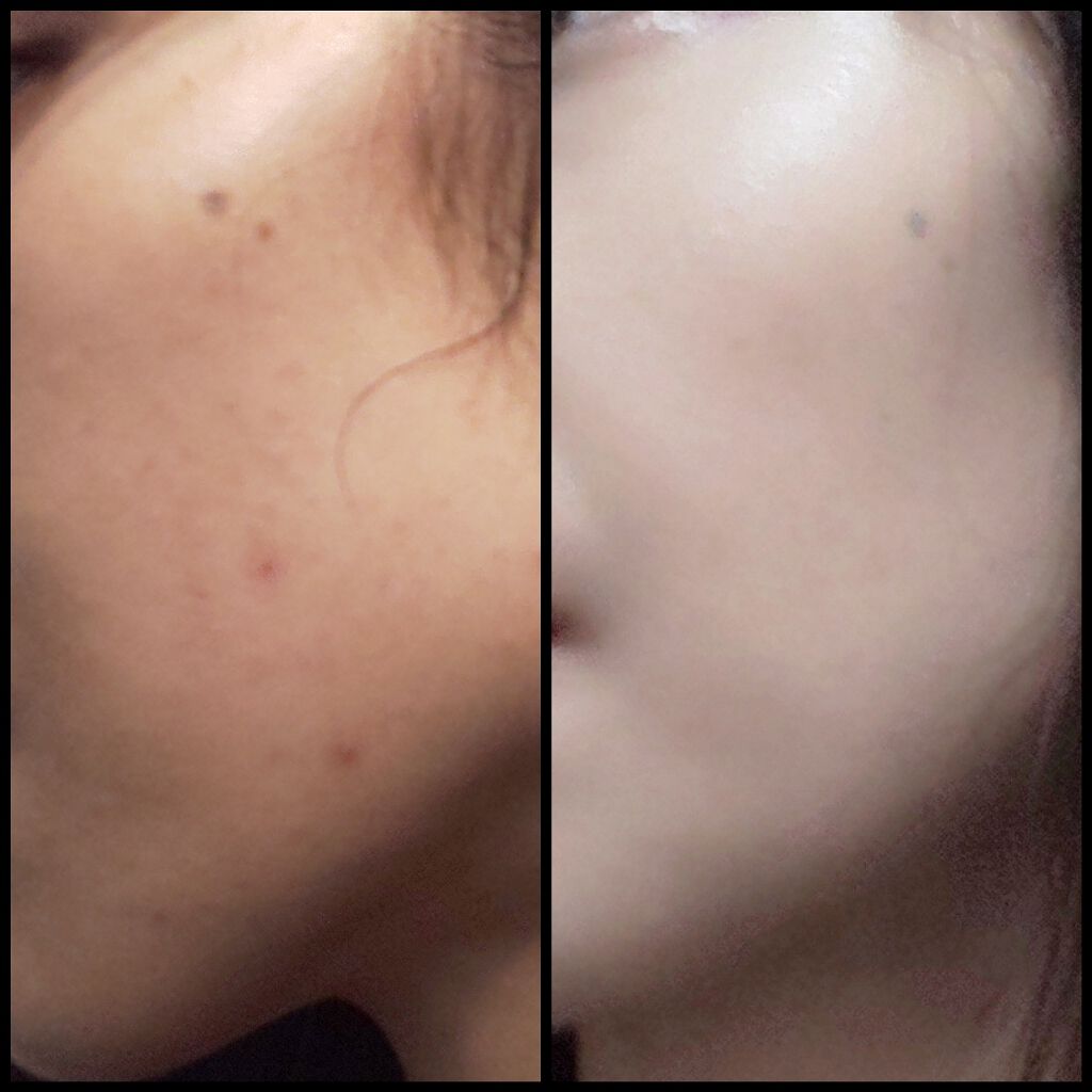 豊潤サジー/フィネス/ドリンクを使ったクチコミ（1枚目）