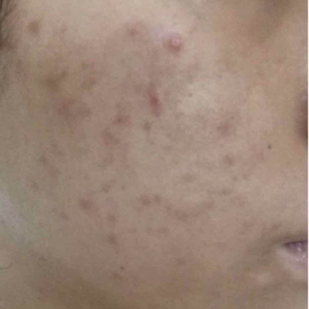 サンホワイトP-1/サンホワイト/ボディクリームを使ったクチコミ（3枚目）