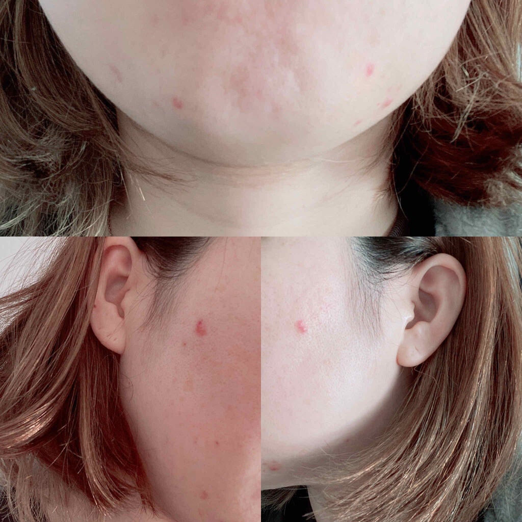 LA10+HAフェイスセラム/The Ordinary/ピーリングを使ったクチコミ(2枚目)