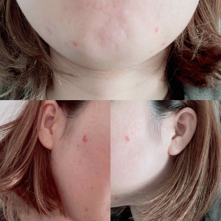 LA10+HAフェイスセラム/The Ordinary/ピーリングを使ったクチコミ(2枚目)