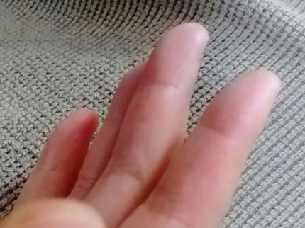 ããªã¬UVãã¢ã¯ã¢ãªãããã¢ã¯ã¢ãã€ã©ã€ãããŒã·ã§ã³ïŒæ°Žå±€ãã€ã©ã€ãUVïŒ/ããªã¬/æ¥çŒãæ¢ãããŒã·ã§ã³ã䜿ã£ãã¯ãã³ãïŒ5æç®ïŒ