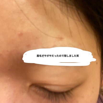 ハトムギ化粧水(ナチュリエ スキンコンディショナー R )/ナチュリエ/化粧水を使ったクチコミ(3枚目)