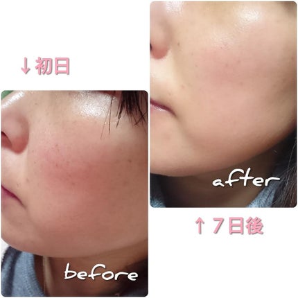 ミラクプロフェッショナル8315/ミラクルプロフェッショナル/化粧水を使ったクチコミ(2枚目)