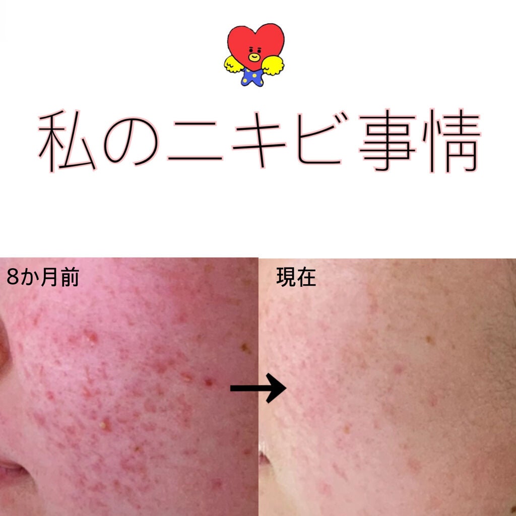 化粧水・敏感肌用・高保湿タイプ/無印良品/化粧水を使ったクチコミ(1枚目)