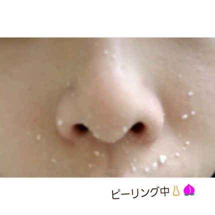 フェイスピーリングジェル ピーチの香り/DAISO/ピーリングを使ったクチコミ(3枚目)