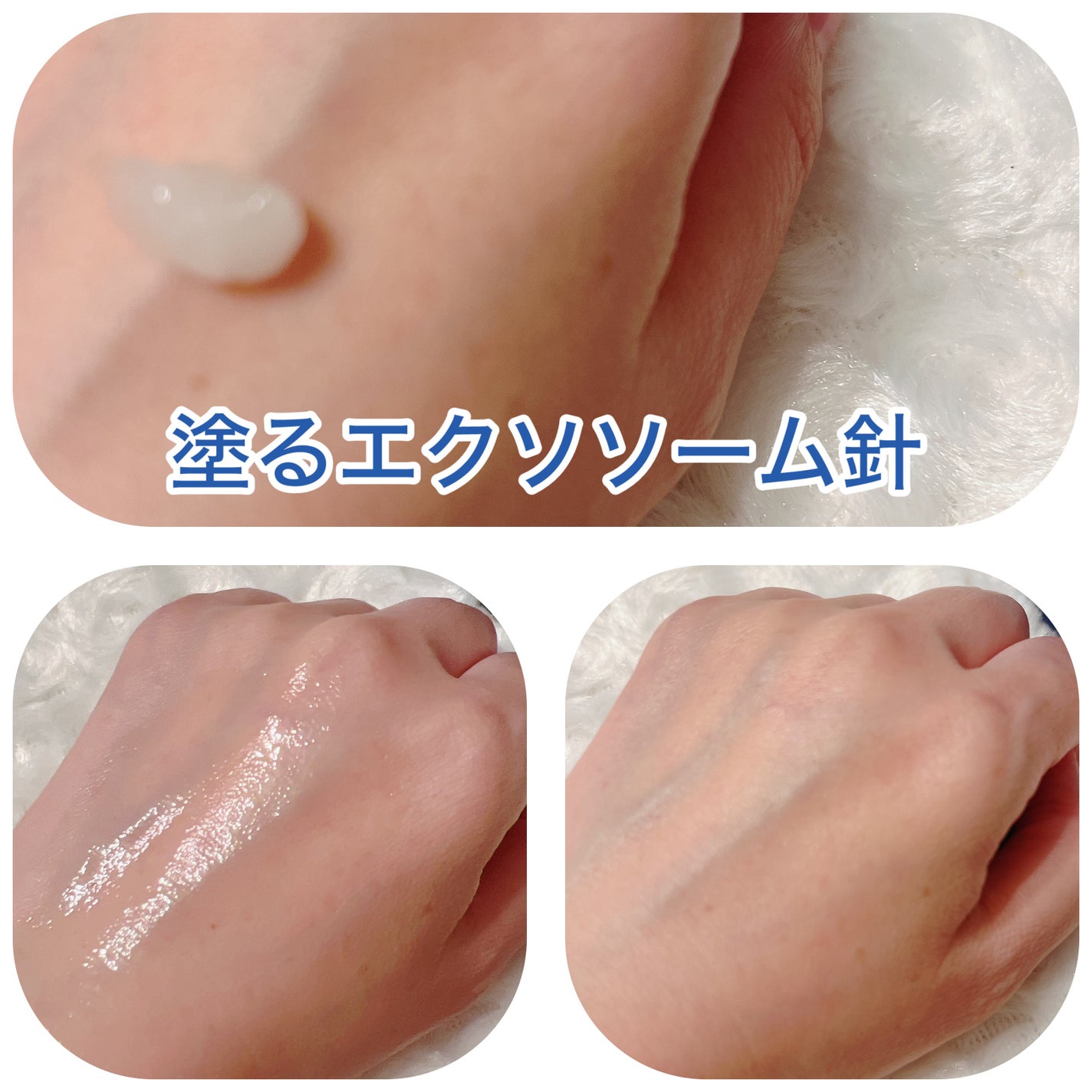 ゼロ毛穴パッド 2.0/MEDICUBE/トナーパッドを使ったクチコミ(4枚目)