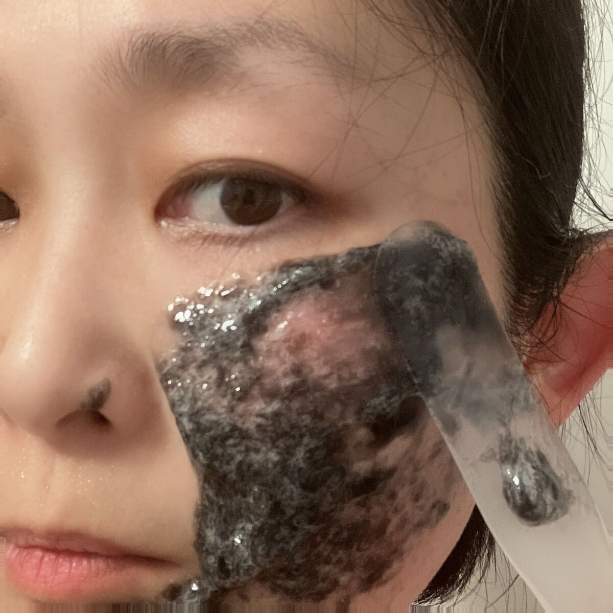 ニードル炭酸パック/NNE/洗い流すパック・マスクを使ったクチコミ(5枚目)