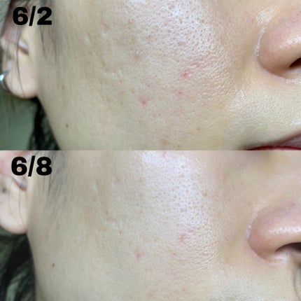 ガラクトミセスピュアビタミンCグロートナー/SOME BY MI/化粧水を使ったクチコミ(2枚目)