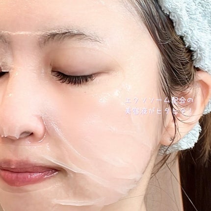 トリートメントリセットマスク/ALFACE+/シートマスク・パックを使ったクチコミ(4枚目)