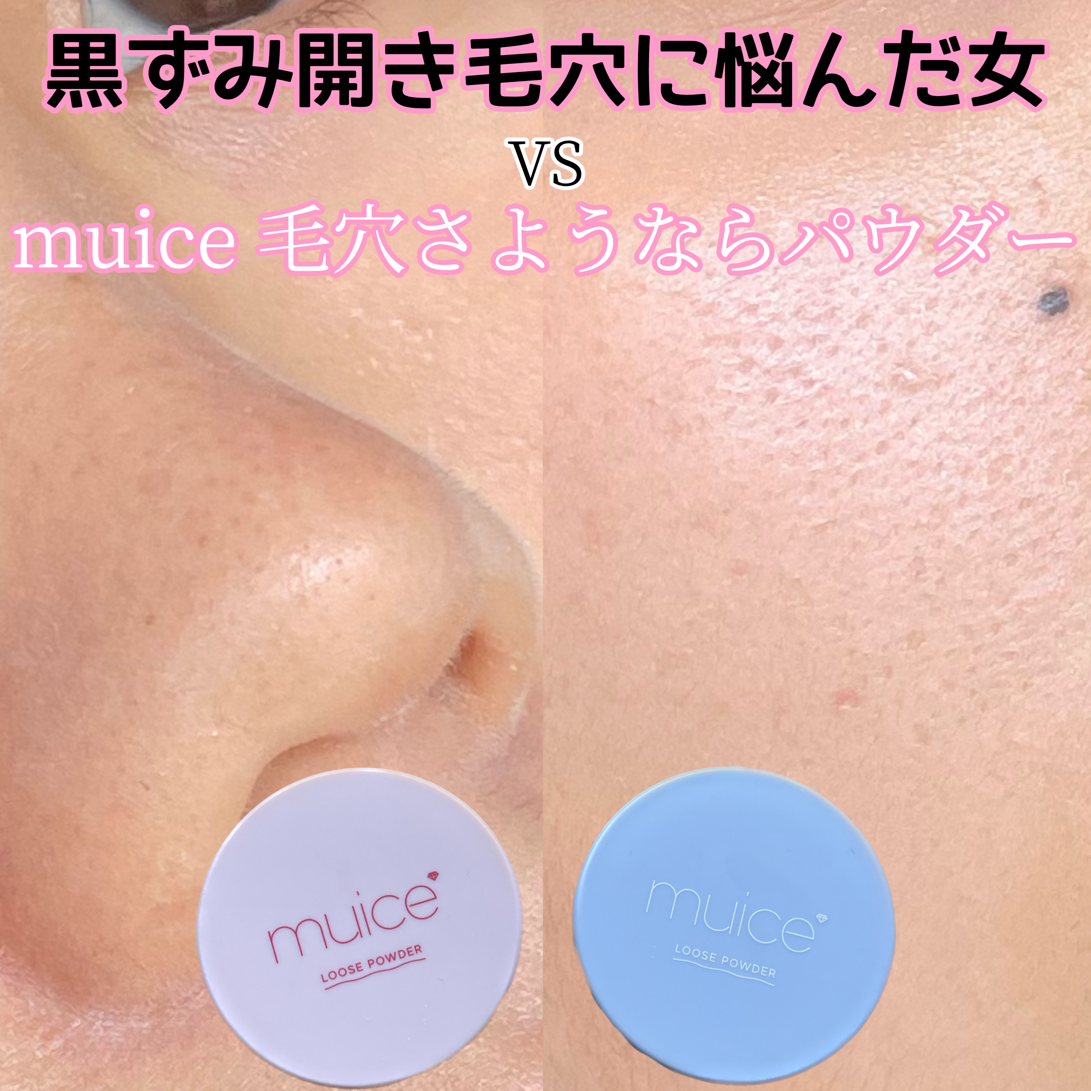 ヨレンパウダー ツヤカバー/muice/ルースパウダーを使ったクチコミ（1枚目）