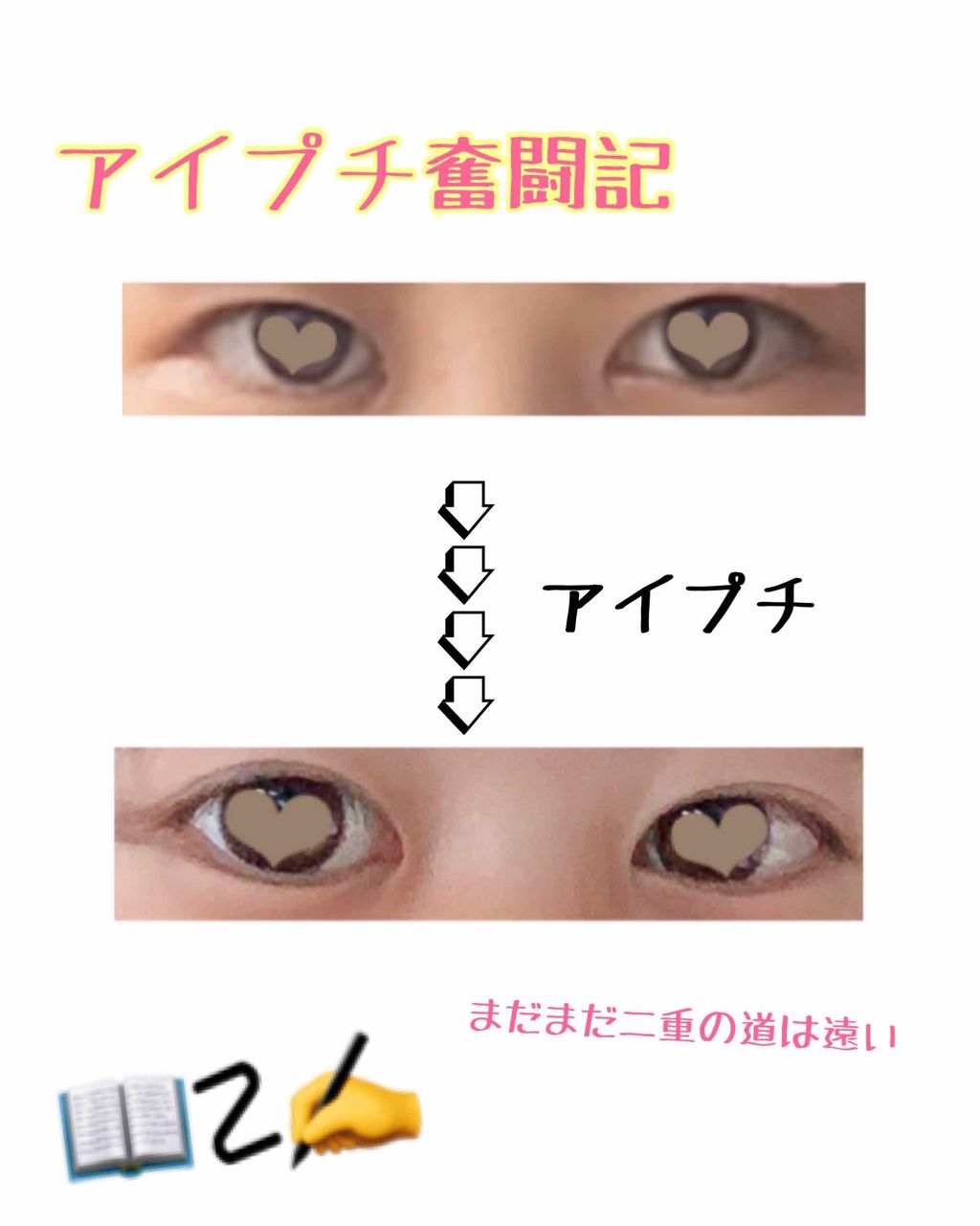 ワンダーアイリッドテープ Extra/D-UP/二重まぶた用アイテムを使ったクチコミ（1枚目）