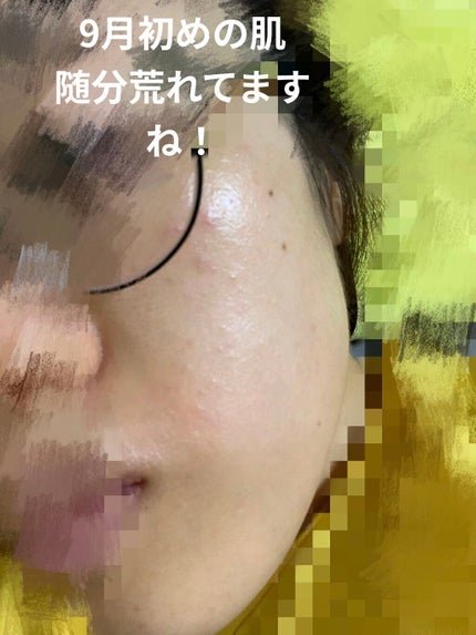 イドラビオ エイチツーオー/ビオデルマ/クレンジングウォーターを使ったクチコミ(2枚目)