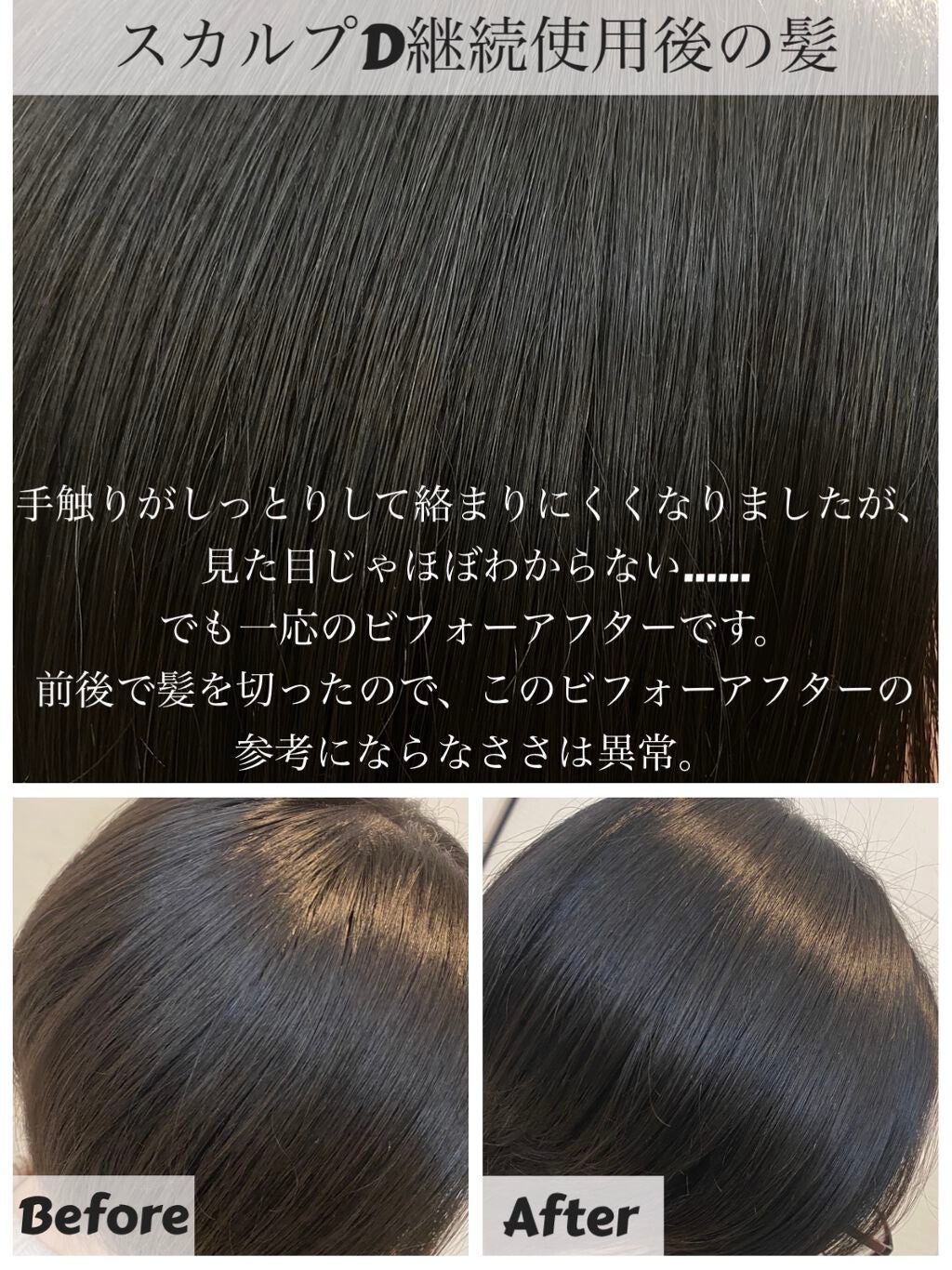 ã¹ã«ã«ãD ããŒã ããã¥ã©ã¹ã¿ãŒ ã¹ã«ã«ãã·ã£ã³ããŒïŒããªãŒãã¡ã³ãããã¯/ã¢ã³ãã¡ãŒ(ã¹ã«ã«ãD)/ã·ã£ã³ããŒã»ã³ã³ãã£ã·ã§ããŒã䜿ã£ãã¯ãã³ãïŒ4æç®ïŒ