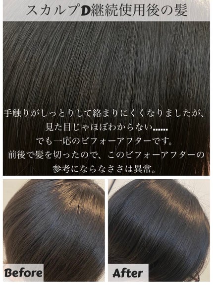 ã¹ã«ã«ãD ããŒã ããã¥ã©ã¹ã¿ãŒ ã¹ã«ã«ãã·ã£ã³ããŒïŒããªãŒãã¡ã³ãããã¯/ã¢ã³ãã¡ãŒ(ã¹ã«ã«ãD)/ã·ã£ã³ããŒã»ã³ã³ãã£ã·ã§ããŒã䜿ã£ãã¯ãã³ãïŒ4æç®ïŒ