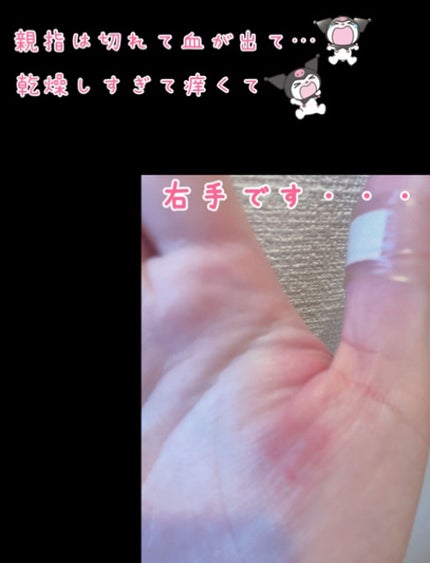 ビューティーチャージ ナイトスペリア/アトリックス/ハンドクリームを使ったクチコミ(4枚目)