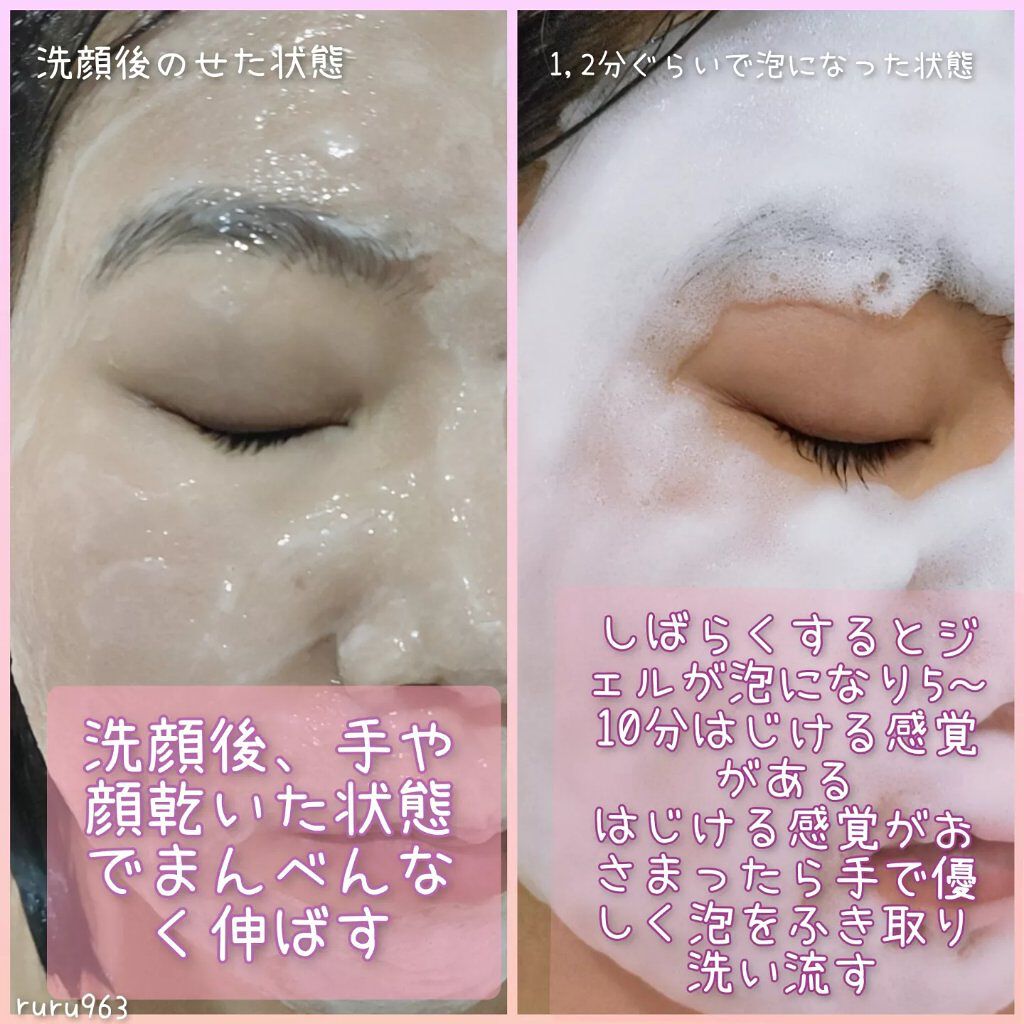 スパークリングジェルパック/antube/洗い流すパック・マスクを使ったクチコミ(4枚目)