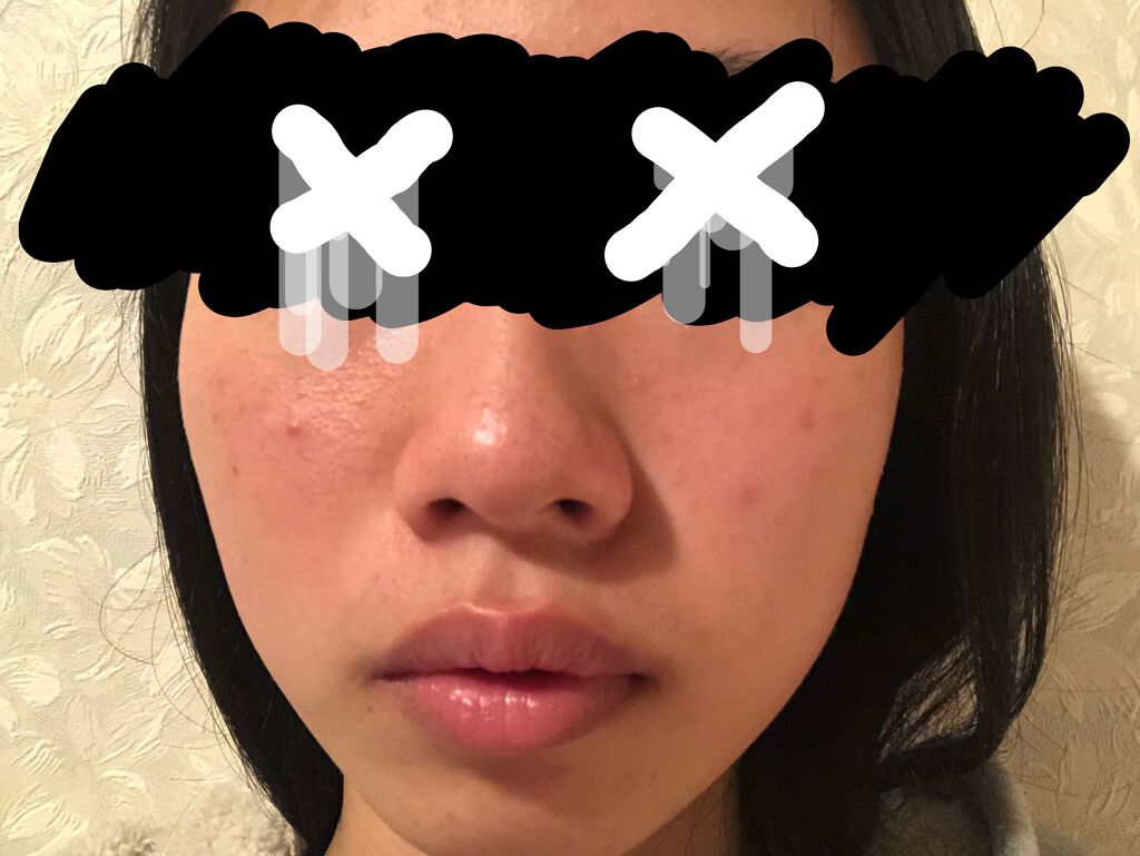 艶肌ドロップ/ラッシュ/美容液を使ったクチコミ（3枚目）