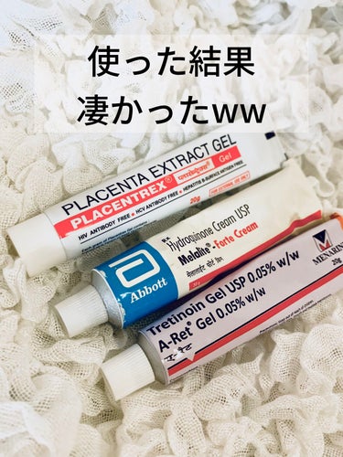 EUKROMA　ハイドロキノンクリーム4%　20g/EUKROMA/その他スキンケアを使ったクチコミ（1枚目）