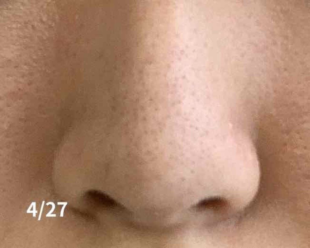 ゼロ毛穴パッド/MEDICUBE/ブースター・導入液を使ったクチコミ(3枚目)