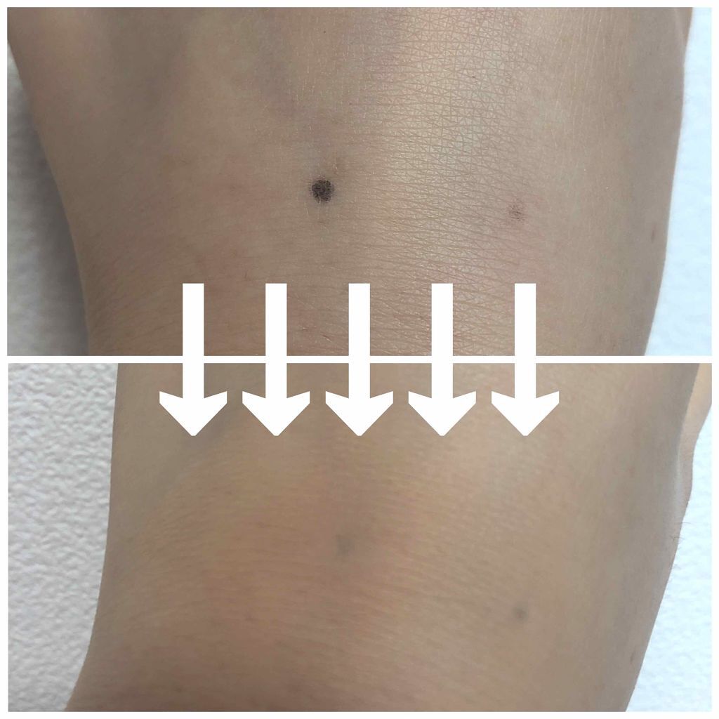 スポッツカバー ファウンデイション/SHISEIDO/クリームコンシーラーを使ったクチコミ(3枚目)