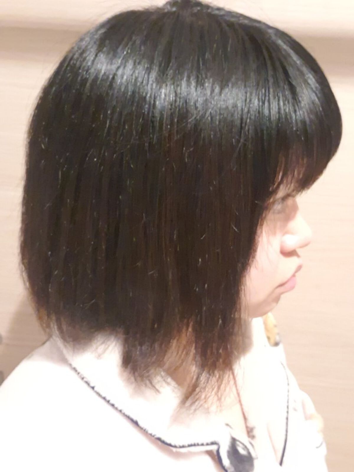 グリセリンP「ケンエー」/健栄製薬/その他を使ったクチコミ（2枚目）