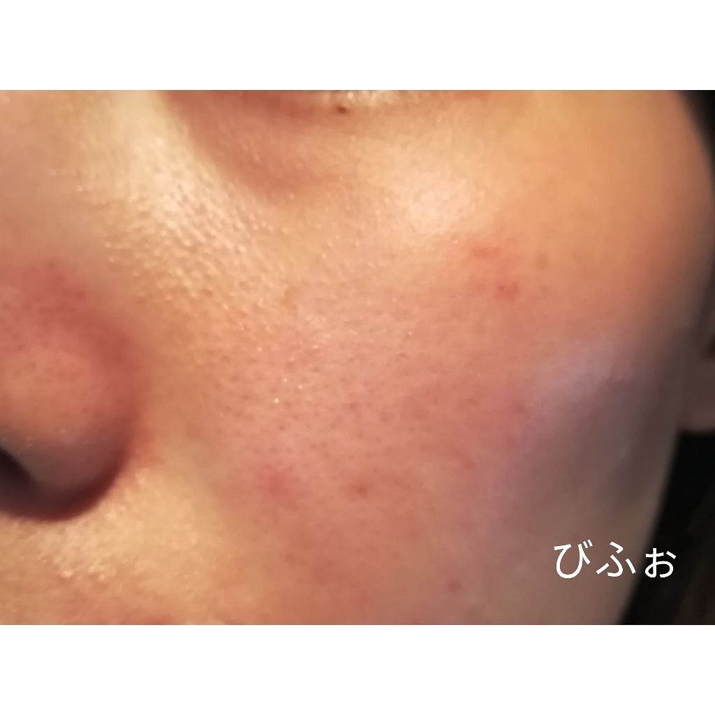 エニークッション オールデイパーフェクト/ETUDE/クッションファンデーションを使ったクチコミ（2枚目）