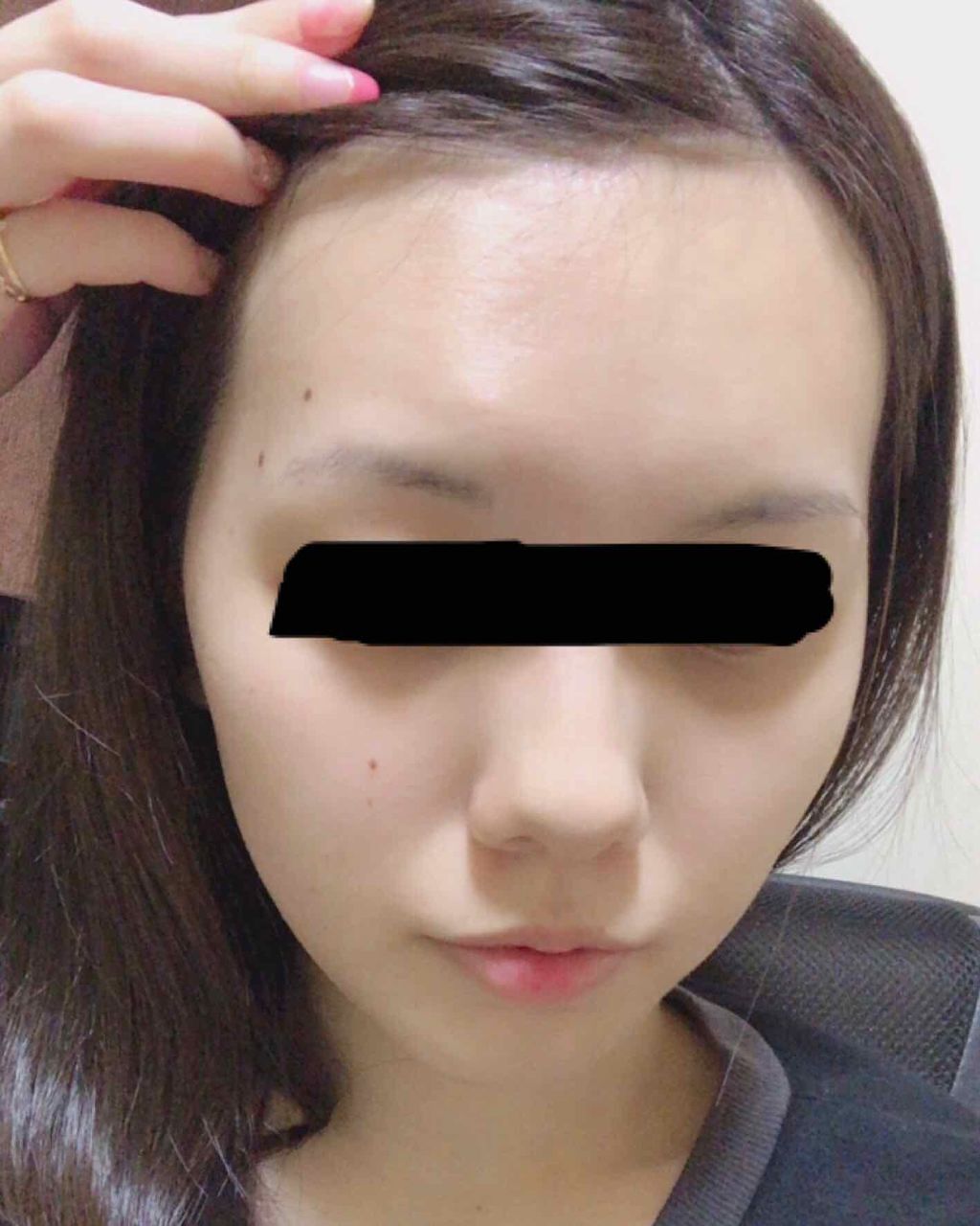 ハトムギ化粧水(ナチュリエ スキンコンディショナー R )/ナチュリエ/化粧水を使ったクチコミ(2枚目)