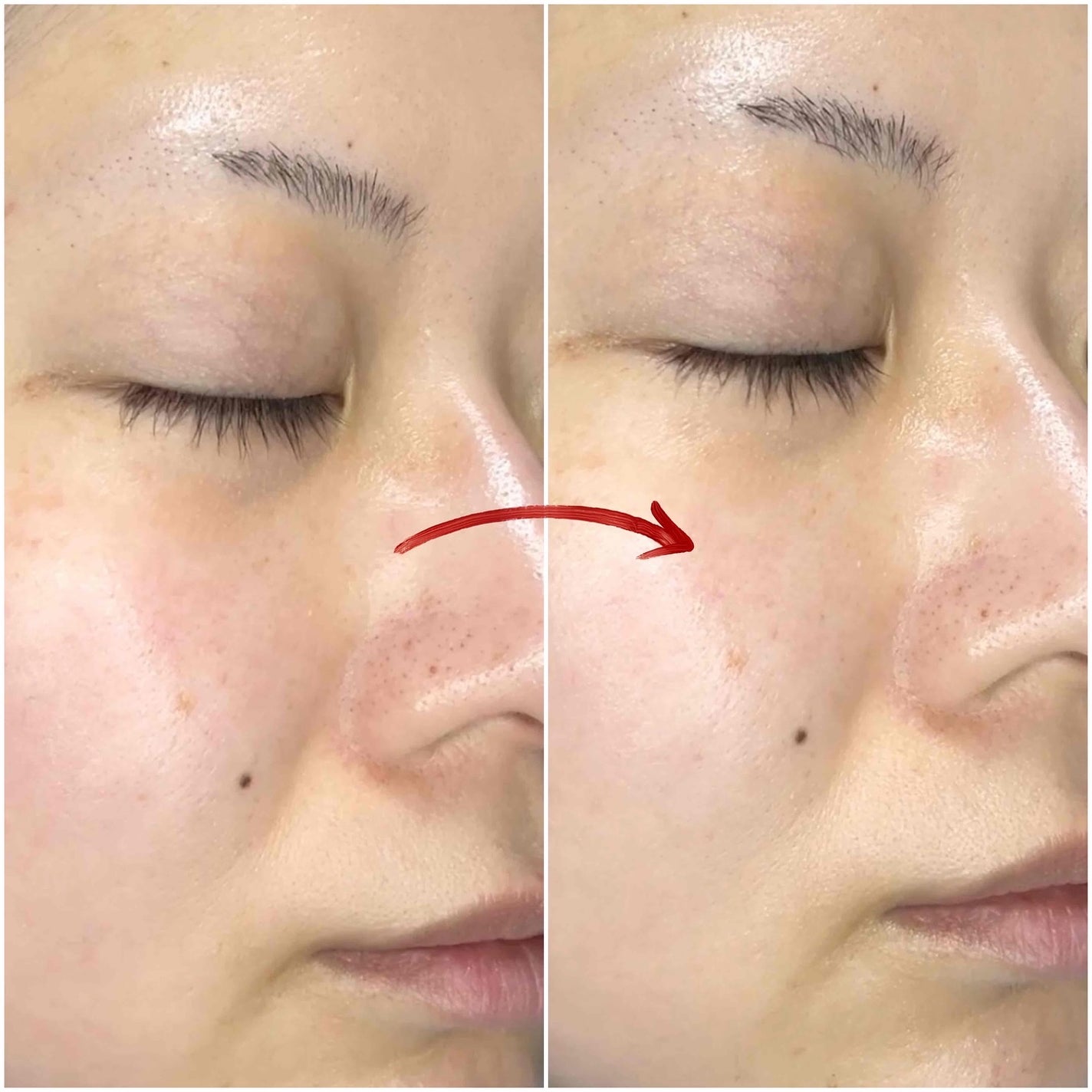 アクアティカサンスクリーン100/Cell Fusion C(セルフュージョンシー)/日焼け止めクリームを使ったクチコミ(5枚目)