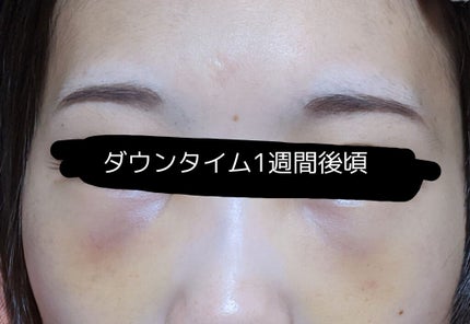 湘南美容外科/その他を使ったクチコミ(3枚目)