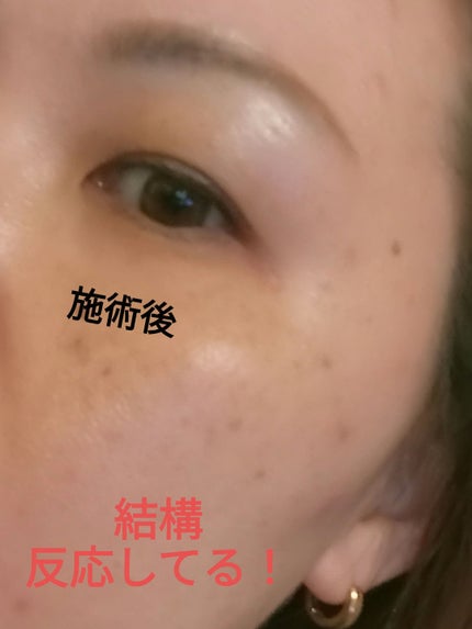 アイディクト byフェアリー/FAIRY/カラーコンタクトレンズを使ったクチコミ(5枚目)