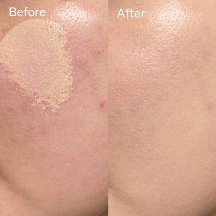 ピンクティーツリーカバークッション/APLIN/クッションファンデーションを使ったクチコミ(7枚目)