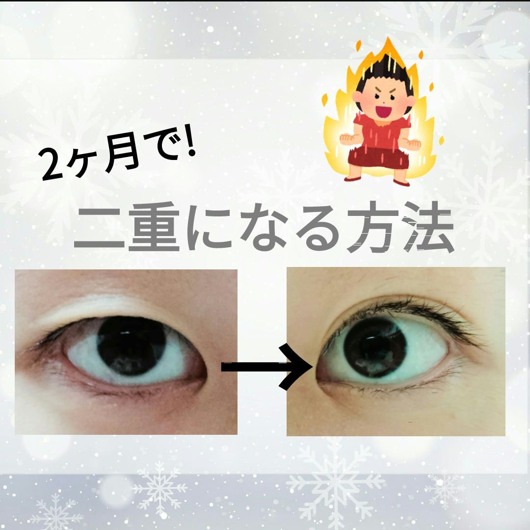 ワンダーアイリッドテープ Extra/D-UP/二重まぶた用アイテムを使ったクチコミ（1枚目）