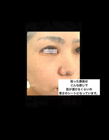 CHOI薬用マスク ニキビケア ［医薬部外品］/肌美精/シートマスク・パックを使ったクチコミ（5枚目）